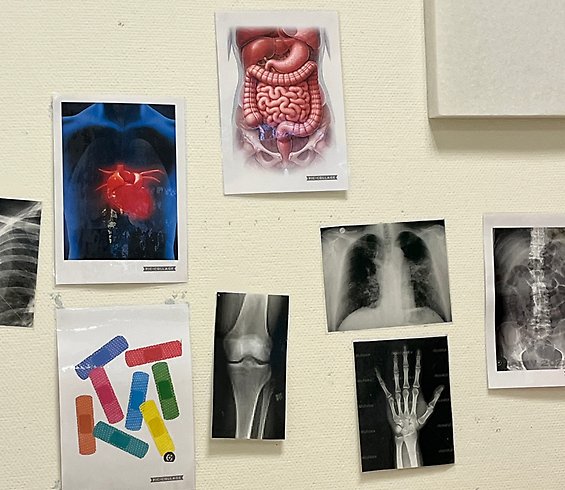 Foton på bilder på en vägg, röntgenbilder m.m.